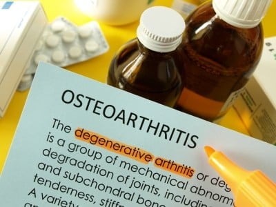osteoarthritis and rheumatoid arthritis